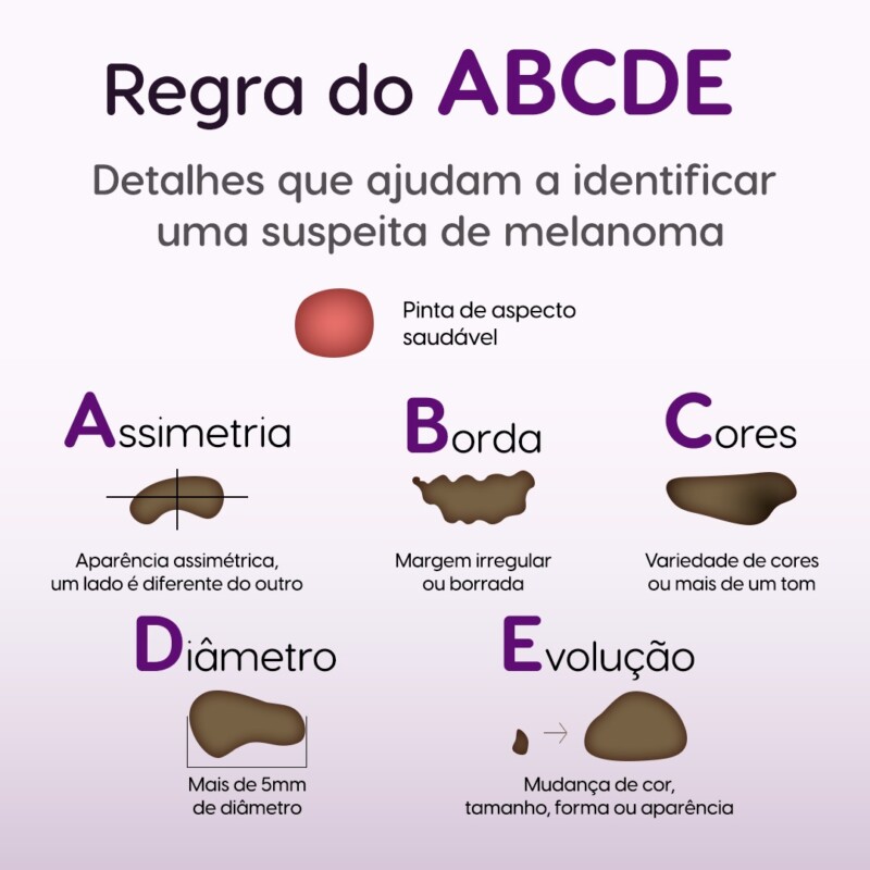 Melanoma Brasil - Foto divulgação